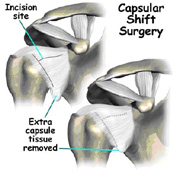 shoulder