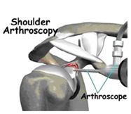 shoulder
