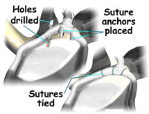 shoulder