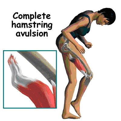 ham2