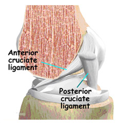 anterior cruciate ligament,acl injury,acl reconstruction india,acl reconstruction best india,acl reconstructionbest doctors in india,acl reconstruction best surgeon in india,acl reconstructionbest surgery in india,acl reconstruction best treatment in india,acl reconstruction in south india,acl reconstruction north india,acl reconstruction east india,acl reconstruction west india,acl reconstruction best in india,acl reconstruction best surgery in india,acl reconstruction cost-effective in india,acl reconstruction best doctors in india,acl reconstruction india,acl reconstruction india,acl reconstruction india,acl reconstruction now in india,acl reconstruction india