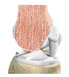 mechanism of injury,acl injury,acl reconstruction india,acl reconstruction best india,acl reconstructionbest doctors in india,acl reconstruction best surgeon in india,acl reconstructionbest surgery in india,acl reconstruction best treatment in india,acl reconstruction in south india,acl reconstruction north india,acl reconstruction east india,acl reconstruction west india,acl reconstruction best in india,acl reconstruction best surgery in india,acl reconstruction cost-effective in india,acl reconstruction best doctors in india,acl reconstruction india,acl reconstruction india,acl reconstruction india,acl reconstruction now in india,acl reconstruction india