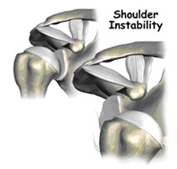 shoulder